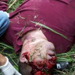 fatal injury