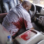 MTN Driver in his pool of blood