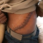 Nigeria kidney 1